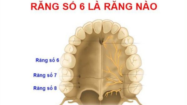 Răng số 6 là răng nào? Hậu quả của mất răng số 6 sớm?