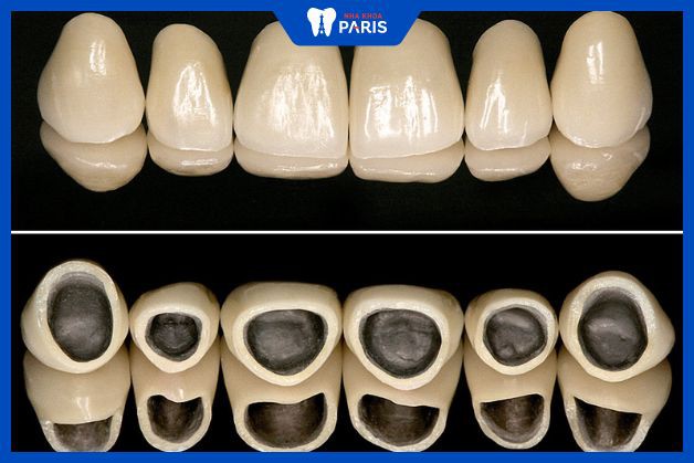 Cấu tạo và ngoại hình 2 loại răng không có nhiều khác biệt
