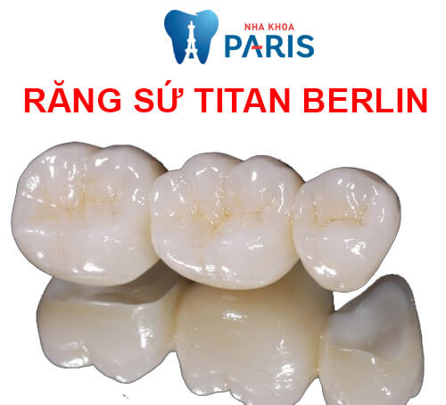 Răng sứ titan berlin