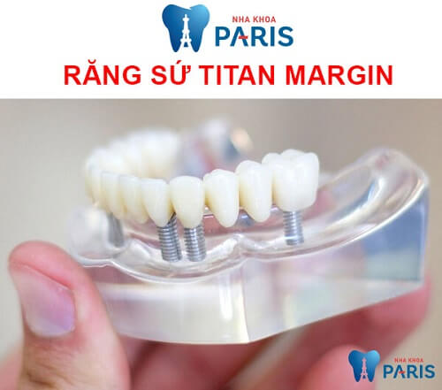 Răng sứ titan margin