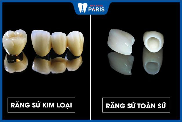 Hai loại răng khác nhau ở chất liệu lõi
