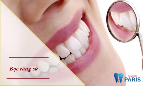 Bọc răng sứ trong trường hợp chân răng tốt, cấu trúc răng chưa bị phá hủy