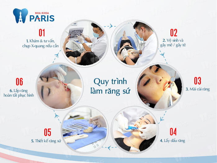 Quy trình làm răng sứ tại Nha Khoa Trồng Răng Implant Paris