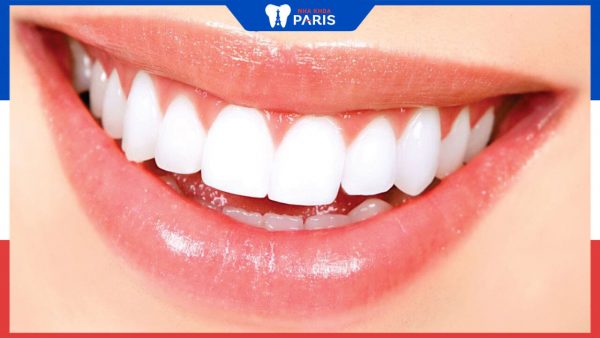 Bọc răng sứ toàn bộ hàm có ưu điểm gì, lưu ý khi bọc sứ