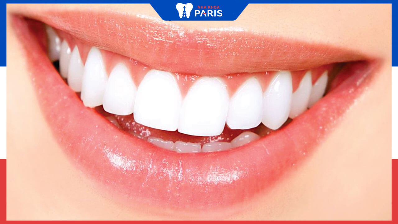 Bọc răng sứ toàn bộ hàm có ưu điểm gì, lưu ý khi bọc sứ