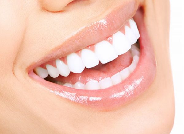 Bọc sứ 16 răng là gì? Lựa chọn răng sứ phù hợp để bọc sứ cho 16 răng