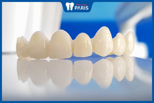 Nên chọn răng sứ nào để bọc răng cho 16 răng