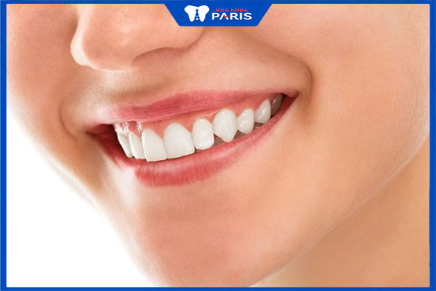 Nguyên nhân của nụ cười hở lợi do xương hàm phát triển quá lớn
