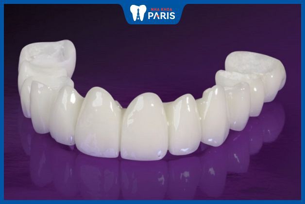 Răng toàn sứ bền chắc và dùng lâu hơn răng sứ kim loại