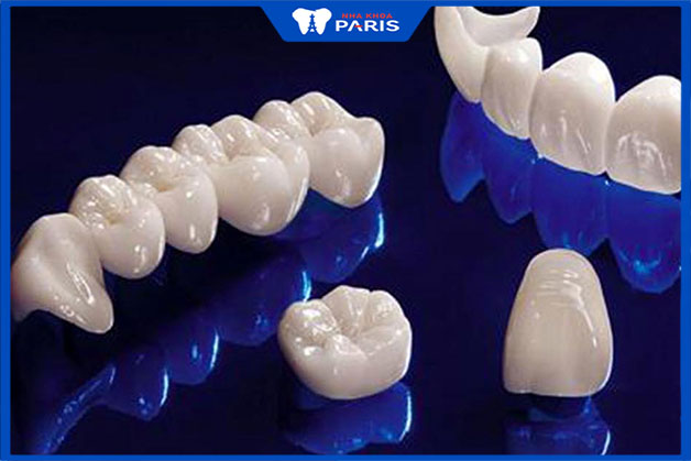 Những vấn đề quan trọng khi bọc răng sứ nguyên hàm