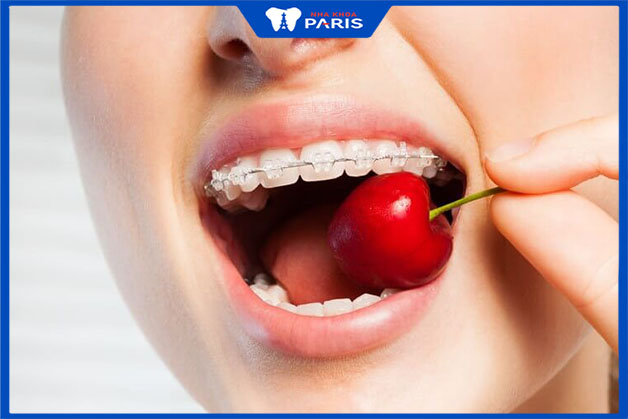 Niềng răng giúp khả năng ăn nhai được khôi phục tối đa