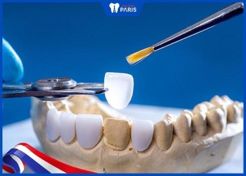 Bọc răng sứ là giải pháp cho tình trạng răng mất, rụng
