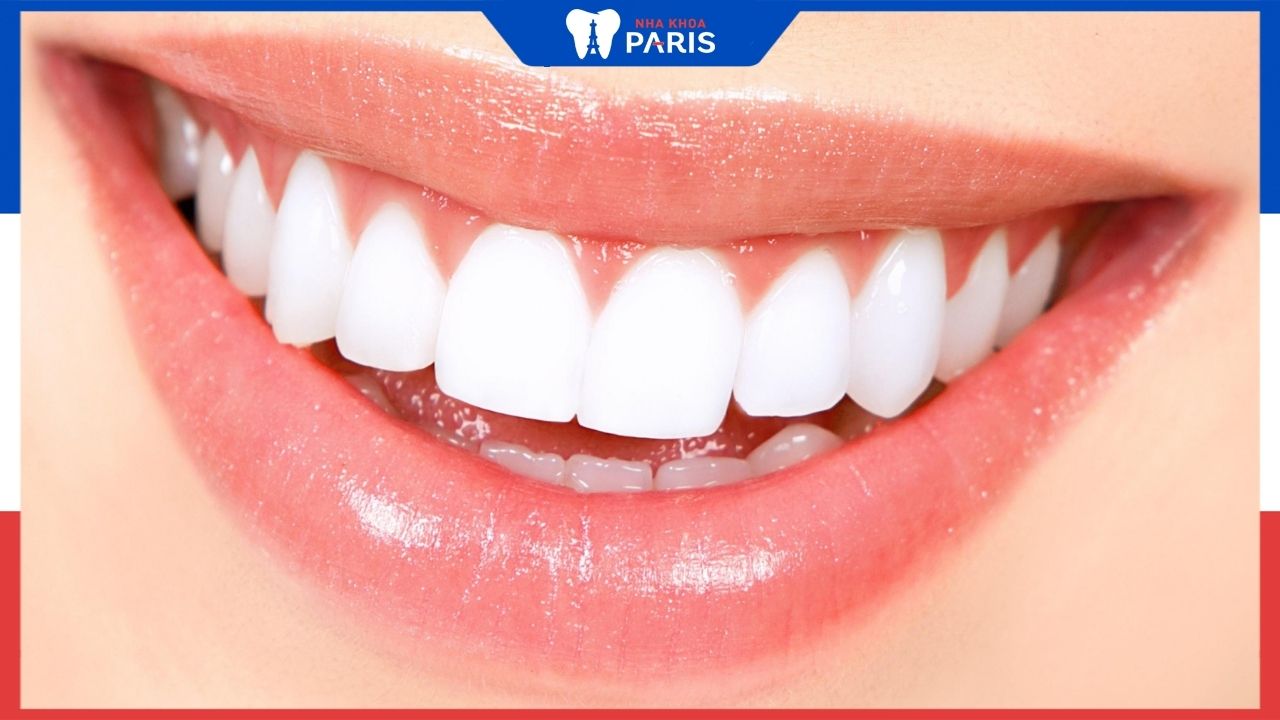 Top 10+ cơ sở bọc răng sứ thẩm mỹ TPHCM uy tín, chất lượng