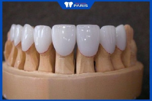 Khắc phục tình trạng răng gặp khuyết điểm