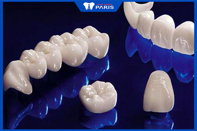 Bọc răng sứ toàn bộ hàm là bọc bao nhiêu răng