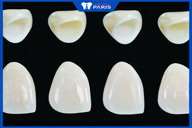 Răng toàn sứ có mấy loại được dùng phổ biến