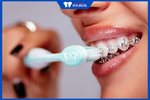 Cách chăm sóc răng miệng