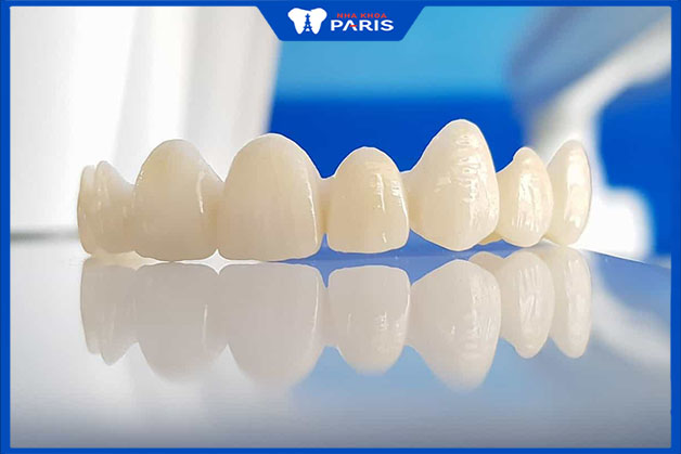Lý do bọc răng toàn sứ có giá như vậy tại Nha khoa Paris