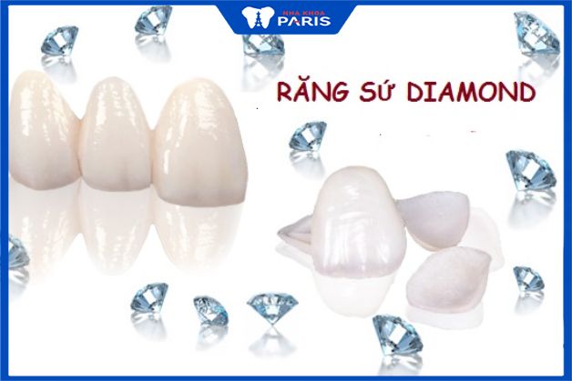 Răng toàn sứ thẩm mỹ kim cương là loại răng toàn sứ tốt nhất, giá thành cũng cao nhất trong tất cả các loại răng sứ. 