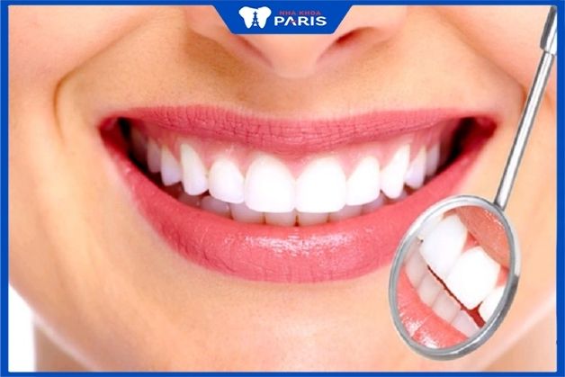 Bọc răng sứ có tuổi thọ bao nhiêu năm?
