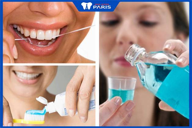 Cần vệ sinh răng miệng đúng cách để kéo dài thời gian sử dụng