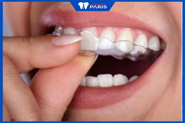 Niềng răng invisalign có tính thẩm mỹ cao, phù hợp với những người thường xuyên giao tiếp