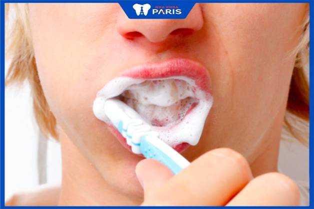 Kỹ thuật đánh răng ảnh hưởng đến độ bền của răng sứ kim loại