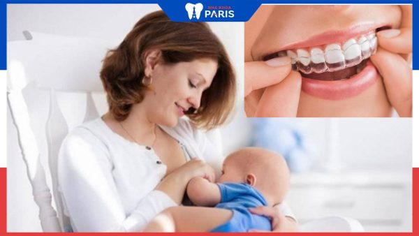 Giải đáp: Sau sinh bao lâu thì niềng răng được? Cần lưu ý gì khi niềng