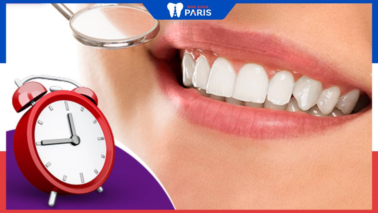 Bọc răng sứ mất bao lâu? 3 yếu tố ảnh hưởng đến thời gian bọc răng sứ