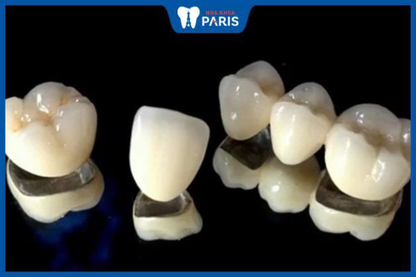 Có nên bọc răng sứ Titan không? 3 loại răng phổ biến