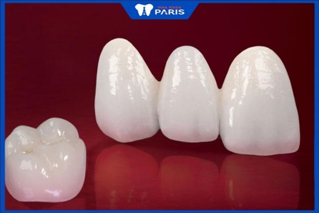 Răng sứ có hình dáng, kích thước như răng thật