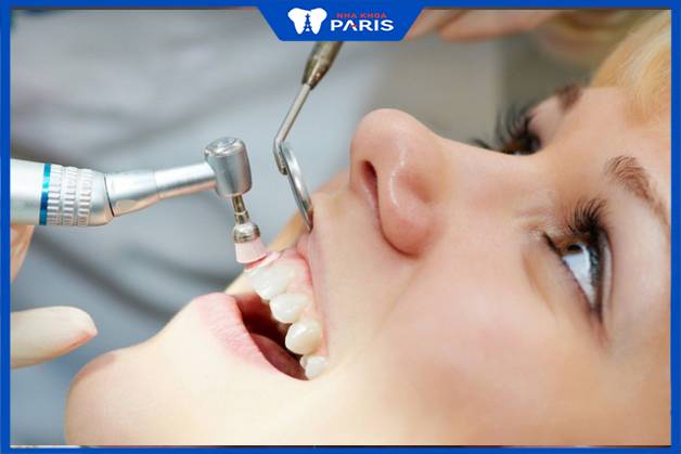 Cạo vôi răng rất an toàn, không ảnh hưởng đến sức khỏe răng miệng