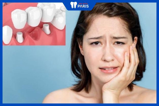 Các cách giảm đau cầu răng sứ