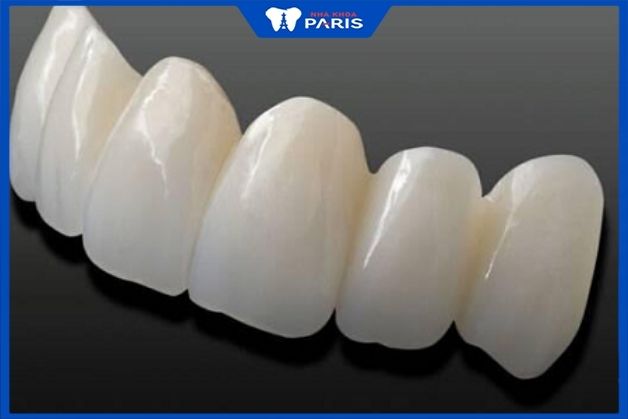Răng toàn sứ Zolid chứa nhiều lợi ích nổi bật