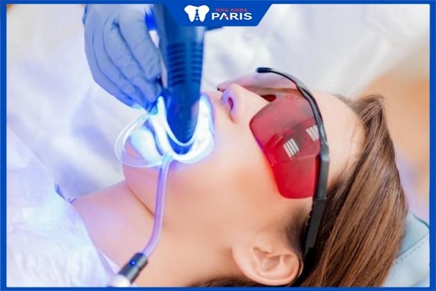 Nha khoa Paris- Địa chỉ tẩy trắng răng uy tín