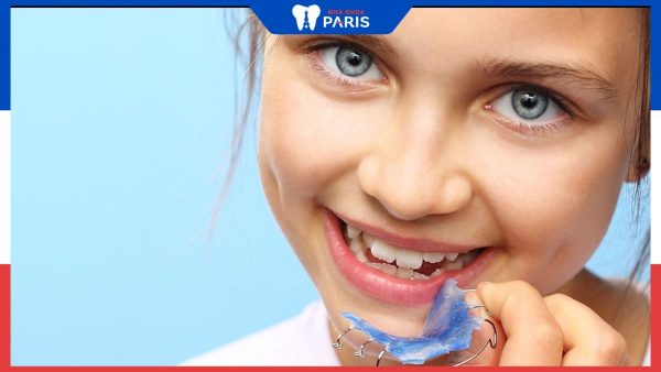 Niềng răng cho trẻ 9 tuổi – Kiến thức cha mẹ cần biết