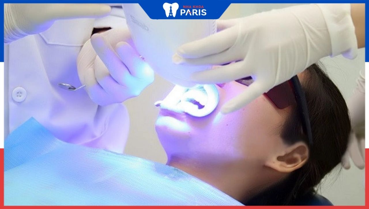 Tẩy trắng răng Laser Whitening có tốt không? Đánh giá từ chuyên gia