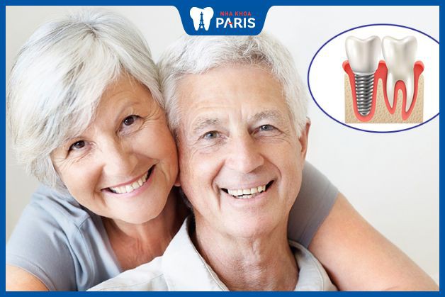 Trồng răng Implant cho người già