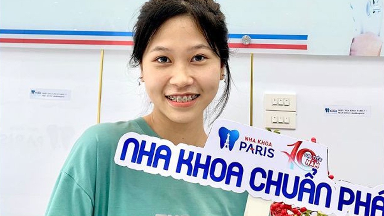 Niềng răng: Giải đáp chi tiết mọi thắc mắc từ A đến Z
