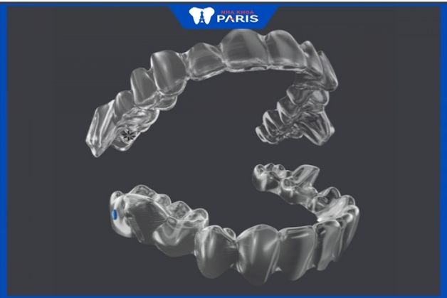 niềng răng invisalign ở hà nội