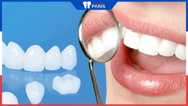 Phục hình răng sứ tại Nha khoa Paris-Tái Tạo Nụ Cười Đẹp