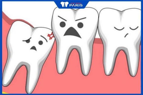 Việc nhổ răng nguy hiểm không không còn phụ thuộc và nhiều yếu tố