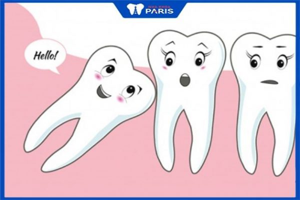 Răng khôn là chiếc răng mọc cuối cùng trong hàm và phát triển khi hàm không còn đủ chỗ chứa