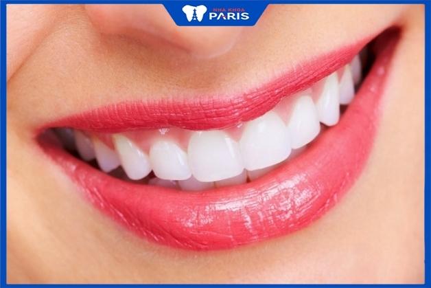 Răng sứ titan có độ bền khoảng 5- 7 năm