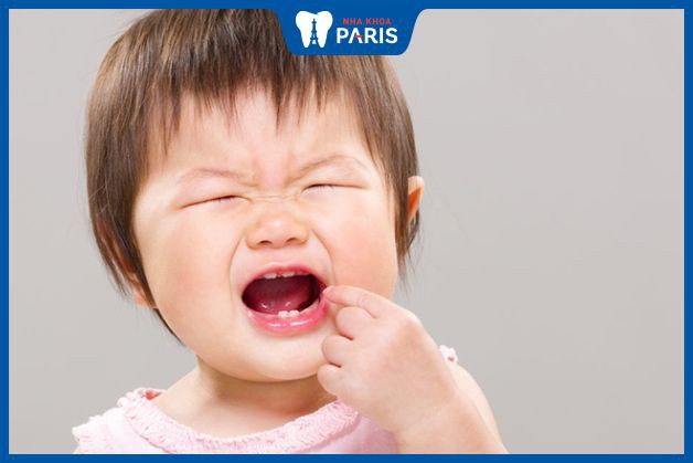 Mọc răng gây khó chịu khiến trẻ quấy khóc
