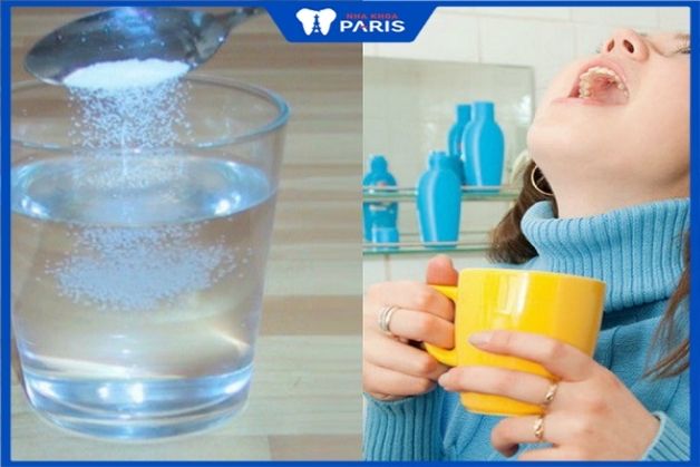Nước muối sinh lý chữa đau răng khôn