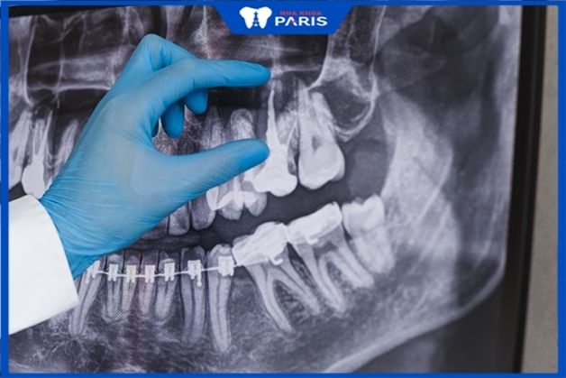 Đến nha sĩ để tìm ra nguyên nhân gây đau răng Đau nhức răng phải làm sao
