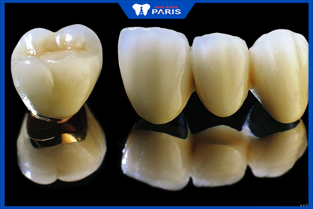 Răng sứ Titan được nhiều khách hàng lựa chọn bọc sứ.