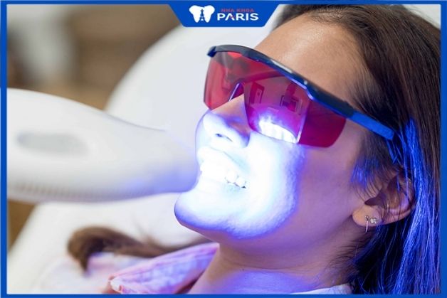 Thuốc tẩy và laser làm tổn hại đến cấu trúc men răng