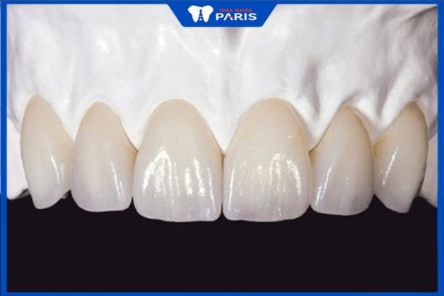 Răng sứ zirconia được đánh giá cao trong các dòng răng toàn sứ